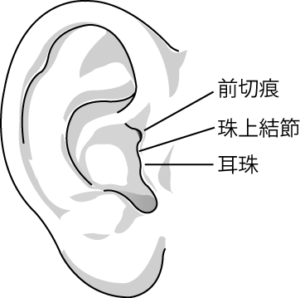 耳介