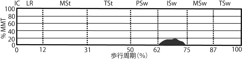 腸骨筋のEMG