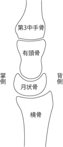 側面(橈側)から見た月状骨