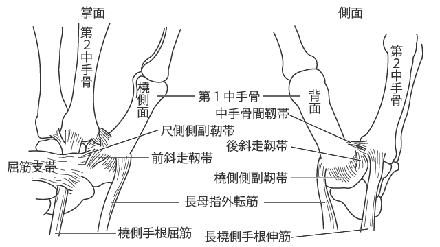 手根中手骨関節形成術とは何ですか?