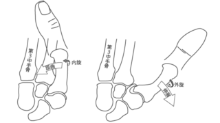 手根中手関節形成術中に期待されること