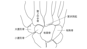 手根中手関節形成術にリスクはありますか?