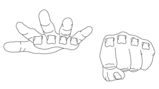 手根中手関節形成術の費用はいくらですか?