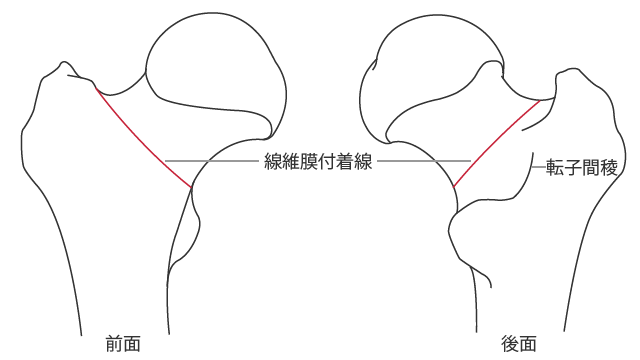 大腿骨における線維膜付着線